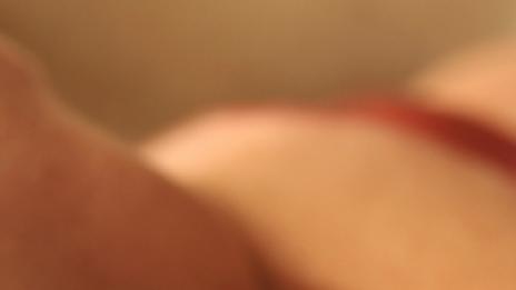 Зачервяване след епилация – спасението