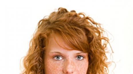 Луничките – чар или бедствие