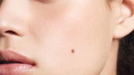 Колко често прави секс? Познайте по бенките