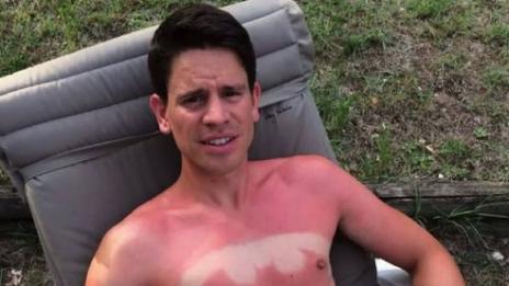 Новата тенденция в мрежата – татуировки от слънчево изгаряне