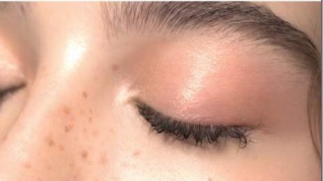 Хидратацията: Най-важното за твоята кожа