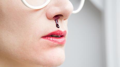 9 знака, че тялото ви страда от недостиг на витамин С