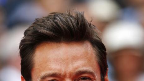 Искате по-гъста брада – вземете коса от скалпа си