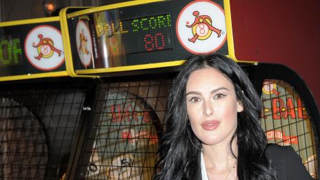 Румър Уилис наду силиконови устни