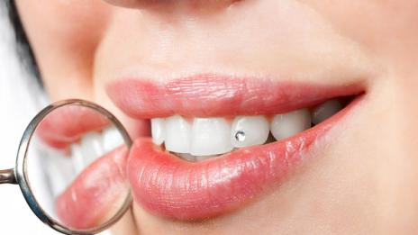 Модерни зъби с блясък и рисунки