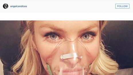 Кандис Суонепол се бори с болест дни преди шоуто на Victoria's Secret