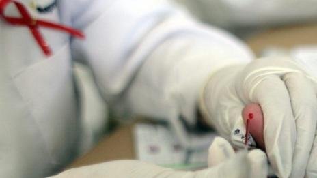 ХИВ не е смъртна присъда!