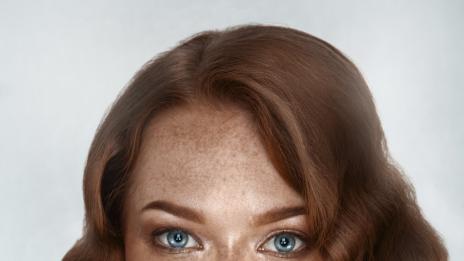 Какво не знаем за луничките?