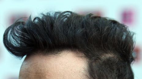 Роби Уилямс се сдоби със син (ВИДЕО)