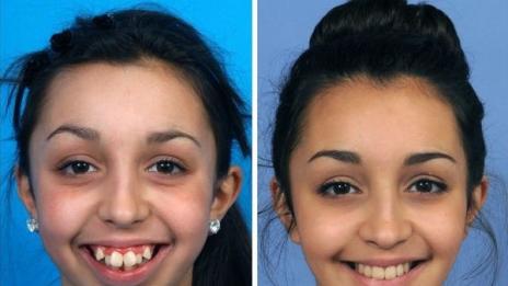 Вдъхновяващо: Промяната на една детска усмивка