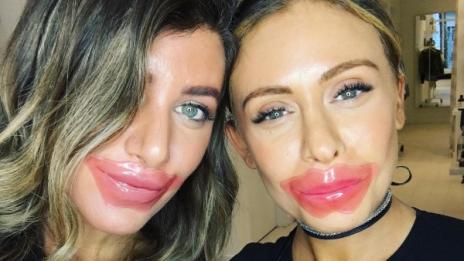 Нов хит: Маски за устни