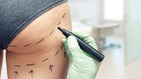 Медици алармират: Преправянето на задните части може да е смъртоносно!