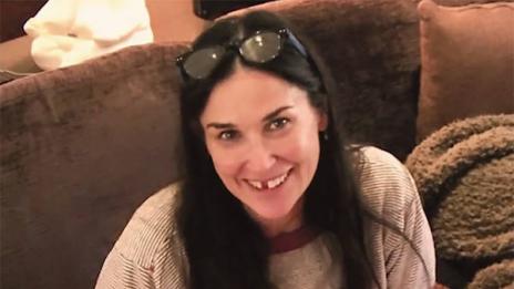 Деми Мур остана без зъби от стрес