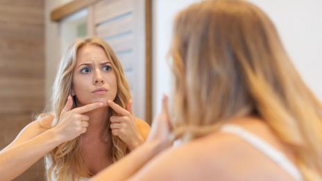 5 съвета, с които да се спасим от акне