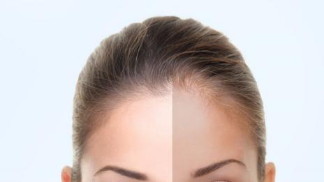 Перфектен тен – без слънце и солариум