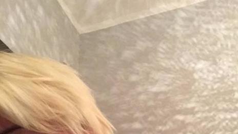 Медици: Причинили болка и страдание на Рут