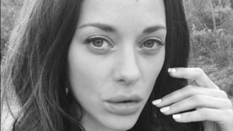 Марион Котияр увеличи устните си