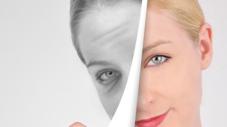 Десетминутна процедура премахва торбичките под очите