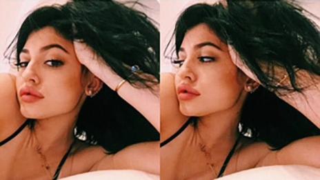 Кайли Дженър май прекали със силикона в устните си