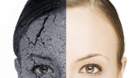 Сухата кожа изисква специално внимание през зимата