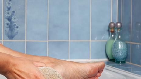 Слънце и горещини: Кои са причините за напуканите пети?