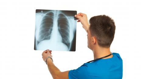 Бели дробове от пушачи са годни за трансплантация