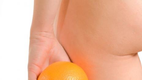 И ето защо целулитът ни мъчи години наред