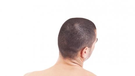 Премахни болките в гърба и кръста. Спечели екзотично пътешествие!