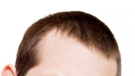 Срамно ли е мъжете да спазват диета