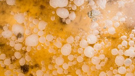 Нещата, които не знаете за мазнините в тялото си