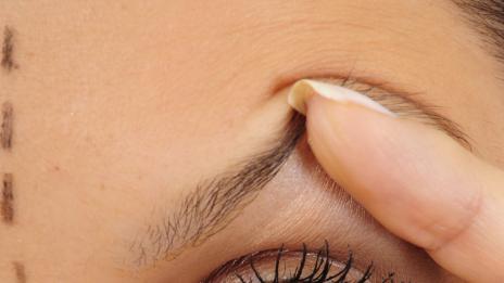 Блефаропластика за по-красиви очи