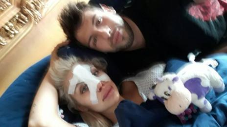 Джулиана Гани с поредна пластика, моделира си носа