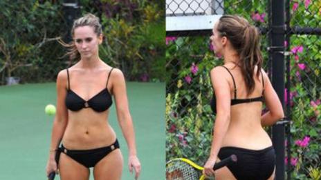 10-те най-големи мита за целулита развенчани