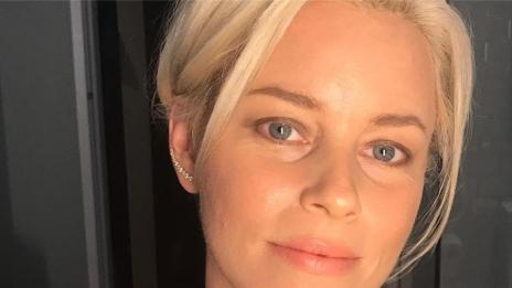 Елизабет Банкс показа снимка, на която е с акне