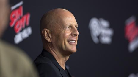 Плешивостта е секси