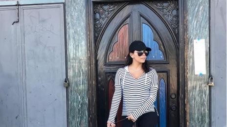 Звездите, които защитиха телата си. Независимо от дефектите!