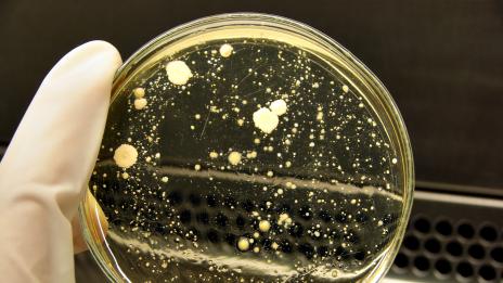 Връзката между гъбичните инфекции и начина ни на хранене