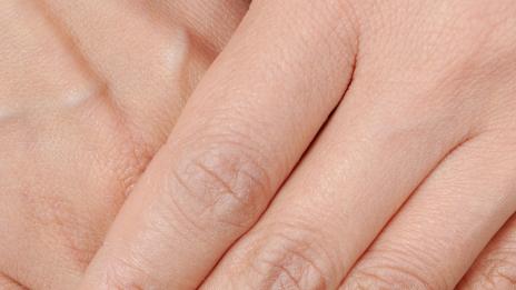 Как да имате здрава и красива ноктопластика