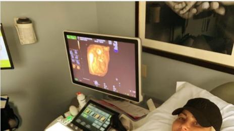 Амбър Роуз чака втори син