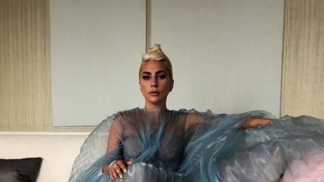 Натискали Гага да си оперира носа