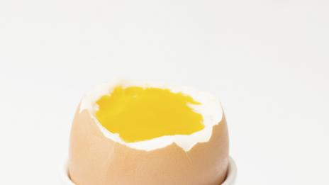 Жизненонеобходимият холестерол