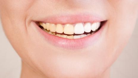 8 ефекта, които усмивката има върху любимите ви хора