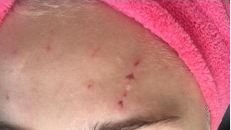 Котка окървави Майли Сайръс