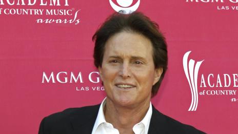 Вторият баща на Ким ще си маха адамовата ябълка