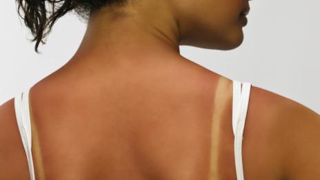 Как да премахнем разликата в тена?