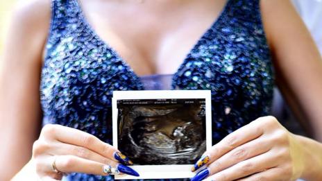 Антония Петрова иска да роди на определена дата