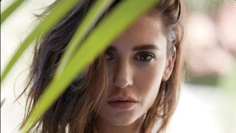 Нина Добрев: Често ми се налага да се боря с пъпки по лицето