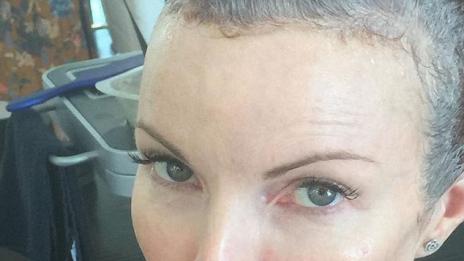 Марша Крос разкри, че се бори с рака