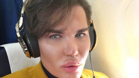 Бразилец напълня, за да си направи по-секси задните части