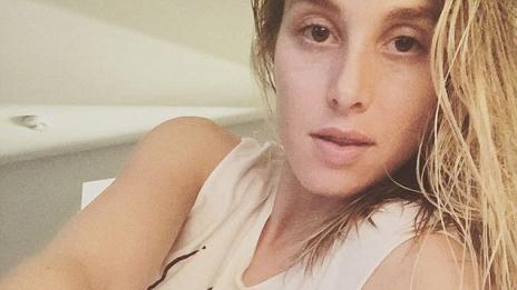 7 знака, че може би имате анемия